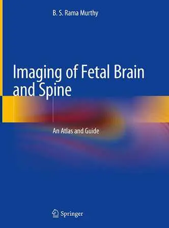 Book cover: Imaging of Fetal Brain and Spine by Dr. B.S. Rama Murthy